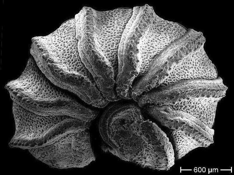 Electron Micrograph, Trachysphaera lobata, Dr Thomas Wesener